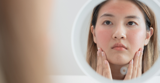 A woman with red, inflamed cheeks examines her reflection in a circular mirror, reflecting the theme "Got Rosacea? Here's How to Deal."