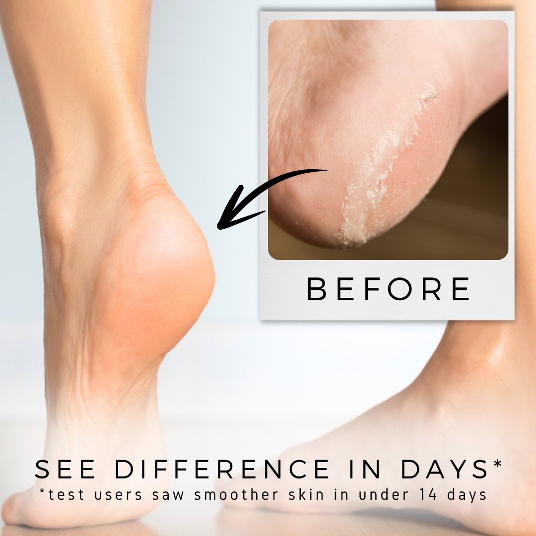 Repair + Soothe Magnesium Cream - Foot Cream, Hand Cream, Dry Skin Moisturizer